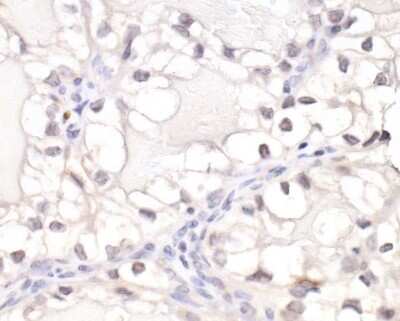 Immunohistochemistry: HIF-1 alpha Antibody [NB100-449]