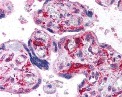 Immunohistological Staining of HIF-1 alpha in Human Placenta