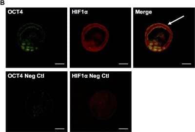 Immunohistological Imaging of HIF-1 alpha in Preimplantation Embryos