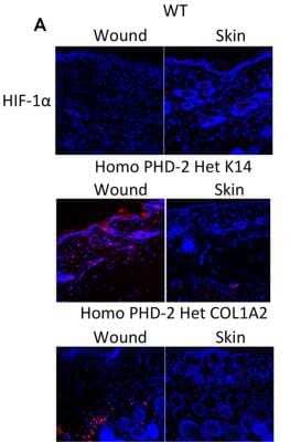 Immunohistological Analysis of HIF-1 alpha in Wounded and non-Wounded Mouse Tissues