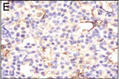 Immunohistochemistry-Paraffin: HIF-1 alpha Antibody [NB100-449]