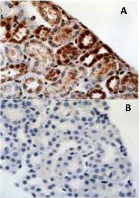 Staining of HIF-1 alpha in Paraffin Embedded Mouse Kidney with and without Blocking Peptide