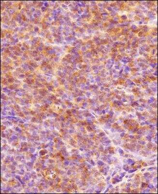 Immunohistochemistry-Paraffin: HIF-1 alpha Antibody - BSA Free [NB100-654]