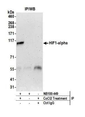 Immunoprecipitation: HIF-1 alpha Antibody [NB100-449]
