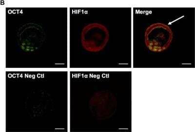Immunohistochemistry: HIF-1 alpha Antibody Pack [NB100-905]