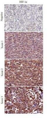 Immunohistochemistry: HIF-1 alpha Antibody Pack [NB100-905]
