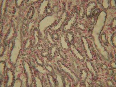 Immunohistochemistry: HIF-1 alpha Antibody Pack [NB100-905]