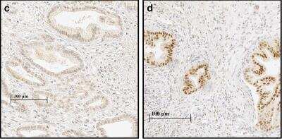 Immunohistochemistry: HIF-1 alpha Antibody Pack [NB100-905]