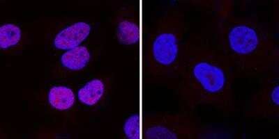 Knockout Validated: HIF-1 alpha Antibody Pack [NB100-905]