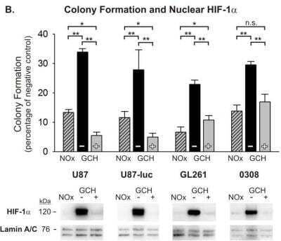 Western Blot: HIF-1 alpha Antibody Pack [NB100-900WB]