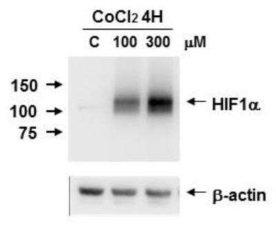 Western Blot: HIF-1 alpha Antibody Pack [NB100-900WB]