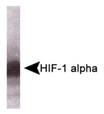 Western Blot: HIF-1 alpha Antibody Pack [NB100-900WB]