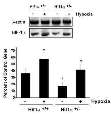 Western Blot: HIF-1 alpha Antibody Pack [NB100-905]