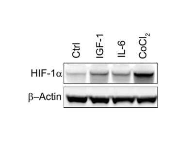 Western Blot: HIF-1 alpha Antibody [NB100-449]