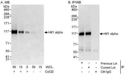 Western Blot: HIF-1 alpha Antibody [NB100-449]