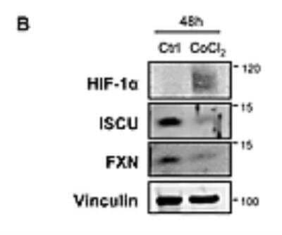 Western Blot: HIF-1 alpha Antibody [NB100-449]