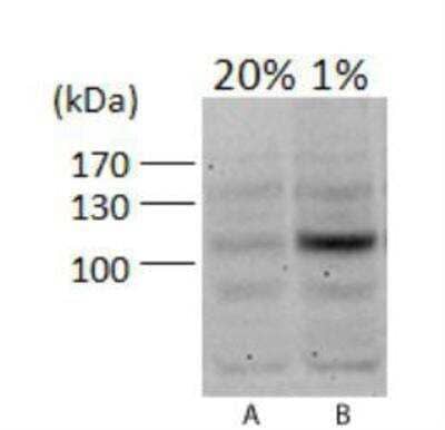 Western Blot Analysis of HIF-1 alpha in PC12 Cells at 20% and 1% Oxygen