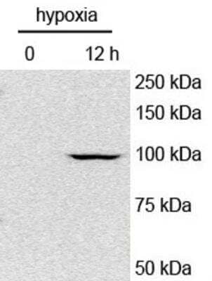 Detection of HIF-1 alpha in Mouse Hepatocytes in Western Blot