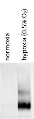 Detection of HIF-1 alpha in U251 Cells by Western Blot