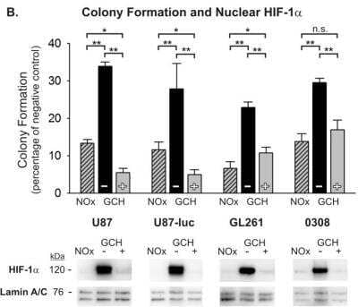 Western Blot Detection of Nuclear HIF-1 alpha in Multiple Cell Types at the Time of Irradiation