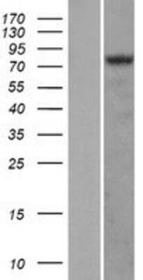 Western Blot: HIF-1 alpha Overexpression Lysate [NBP2-04440]