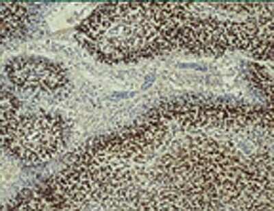 Immunohistochemistry: ARNT/HIF-1 beta Antibody Pack [NB100-982]