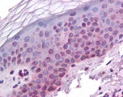 Immunohistochemistry: ARNT/HIF-1 beta Antibody Pack [NB100-982]