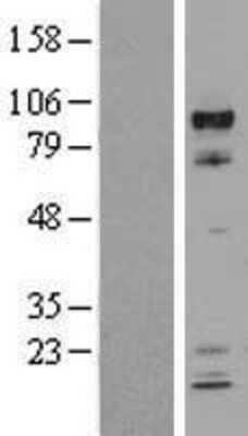 Western Blot: ARNT/HIF-1 beta Overexpression Lysate [NBL1-07720]