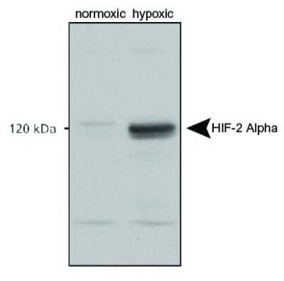 HIF-2 alpha/EPAS1 Detection in Normoxic and Hypoxic Nuclear Rat Cell Lysates by Western Blot