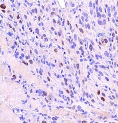 Immunohistochemistry: HIF-2 alpha/EPAS1 Antibody (2444A) - Azide and BSA Free [NBP2-80767]