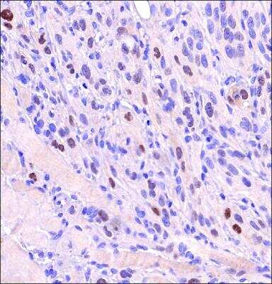 Immunohistochemistry-Paraffin: HIF-2 alpha/EPAS1 Antibody (2444A) - BSA Free [NBP2-76454]