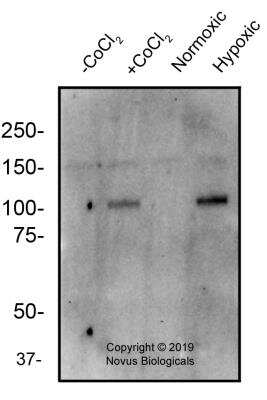 Western Blot: HIF-2 alpha/EPAS1 Antibody (2444A)BSA Free [NBP2-76454]