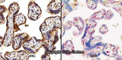 Dual RNAscope ISH-IHC Analysis of HIF-2 alpha/EPAS1 in Human Placenta
