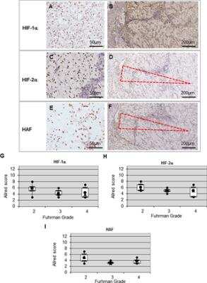 Immunohistological Analysis of HIF-1 alpha, HIF-2 alpha/EPAS1 and HAF in ccRCC
