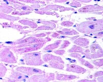 Immunohistological Staining of HIF-2 alpha/EPAS1 in Paraffin Embedded Human Cardiac Myocytes