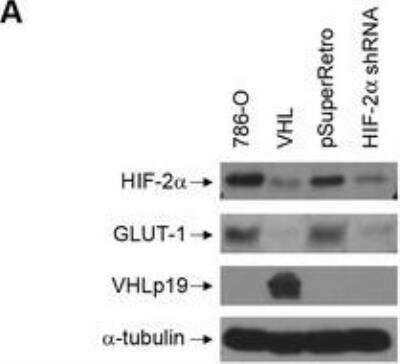 Knockdown Validation of HIF-2 alpha/EPAS1 Antibody in 786-O Cells