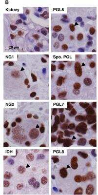 Immunohistochemistry: HIF-2 alpha/EPAS1 Antibody Pack [NB100-902HIF2]