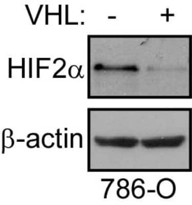 Western Blot Detection of HIF-2 alpha/EPAS1 in 786-O Cells With or Without VHL Overexpression
