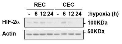 Detection of HIF-2 alpha/EPAS1 in Human Retinal and Choroidal Primary Endothelia Lysates by Western Blot