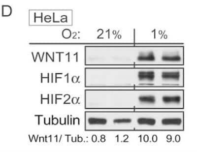 Western Blot Analysis of HIF-2 alpha/EPAS1 in Hypoxic and non-Hypoxic HeLa Cells