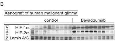 HIF-2 alpha/EPAS1 Expression in Control and Bevacizumab-Treated Tumors Detected by Western Blot