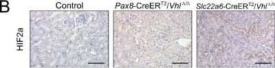 Immunohistochemistry: HIF-2 alpha/EPAS1 Antibody (ep190b) - Azide and BSA Free [NBP2-80766]