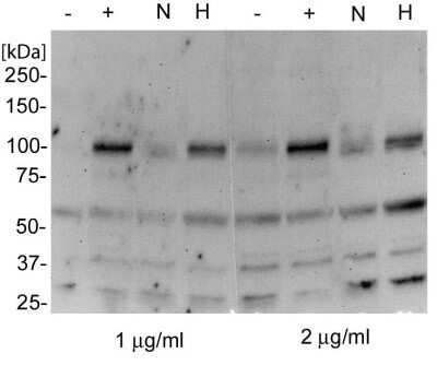 Western Blot: HIF-2 alpha/EPAS1 Antibody (ep190b)Azide and BSA Free [NBP2-80766]