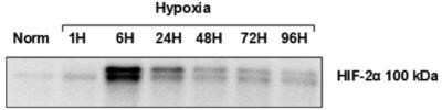 Western Blot: HIF-2 alpha/EPAS1 Antibody (ep190b)Azide and BSA Free [NBP2-80766]