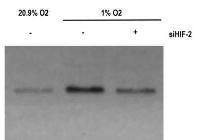 Western Blot: HIF-2 alpha/EPAS1 Antibody (ep190b)Azide and BSA Free [NBP2-80766]