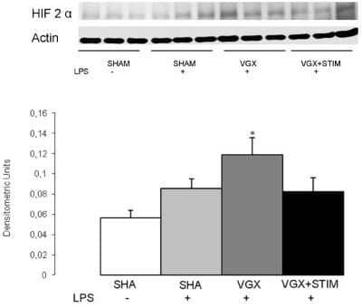 Western Blot: HIF-2 alpha/EPAS1 Antibody (ep190b)Azide and BSA Free [NBP2-80766]