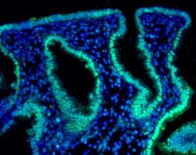 Immunohistochemistry: HIF-2 alpha/EPAS1 Antibody (ep190b) [NB100-132]