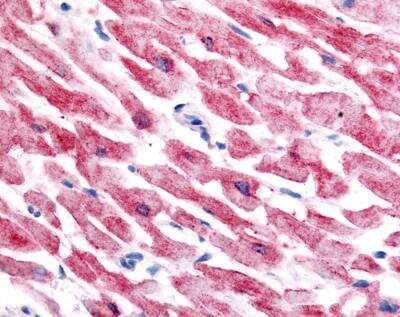 Immunohistochemistry-Paraffin: HIF-2 alpha/EPAS1 Antibody (ep190b) [NB100-132]