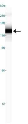 Simple Western: HIF-2 alpha/EPAS1 Antibody (ep190b) [NB100-132]