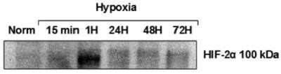 Western Blot: HIF-2 alpha/EPAS1 Antibody (ep190b) [NB100-132]